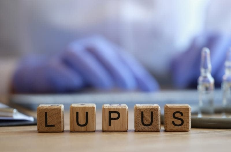 <p><span style="color: rgb(91, 37, 118);">Exploring the Connection Between Lupus and Hair Loss</span></p>