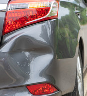 Dents